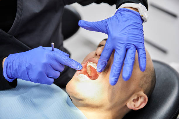Best Emergency Root Canal Treatment in Fort Carson, CO